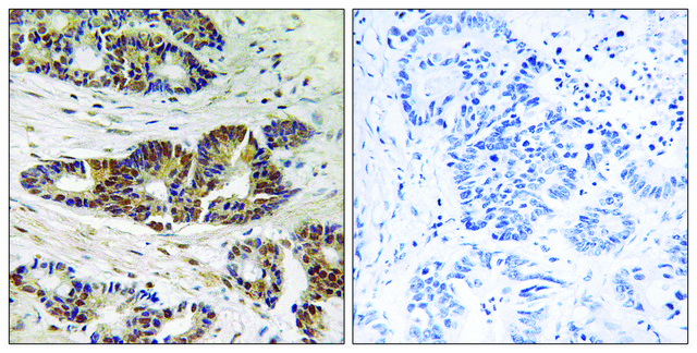 Anti-GRK2 antibody produced in rabbit