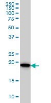Monoclonal Anti-SRI antibody produced in