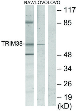 Anti-TRIM38 antibody produced in rabbit