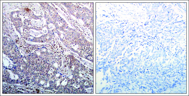 Anti-phospho-NFKBIB (pSer²³) antibody produced in