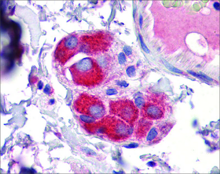 Anti-ZFP36 antibody produced in rabbit