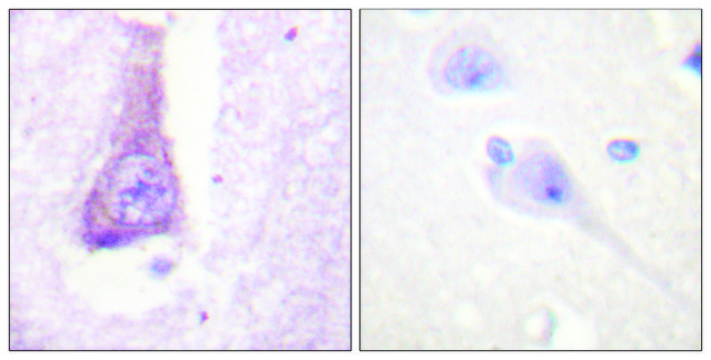 Anti-WASP antibody produced in rabbit