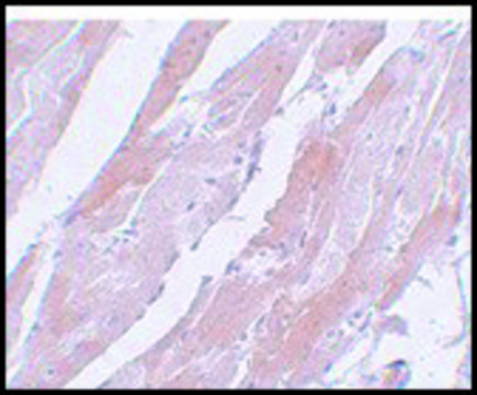 Anti-CCDC47 antibody produced in rabbit