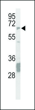 ANTI-STEP / PTPN5(N-TERMINAL) antibody produced