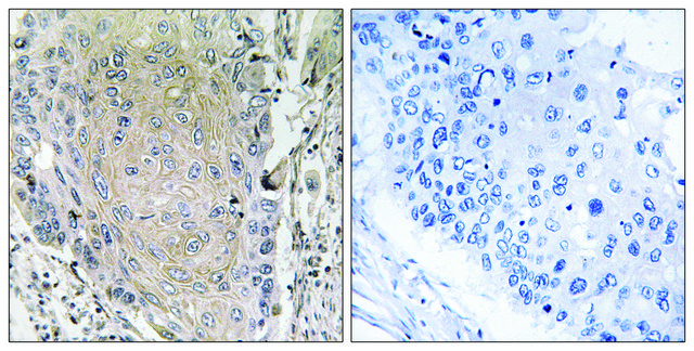 Anti-CBLN3, antibody produced in rabbit