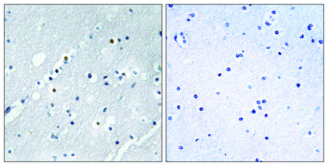 Anti-Histone H2B antibody produced in