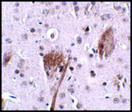 Anti-SPG11 antibody produced in rabbit