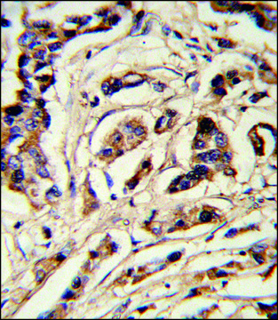 ANTI-TSHB (CENTER) antibody produced in