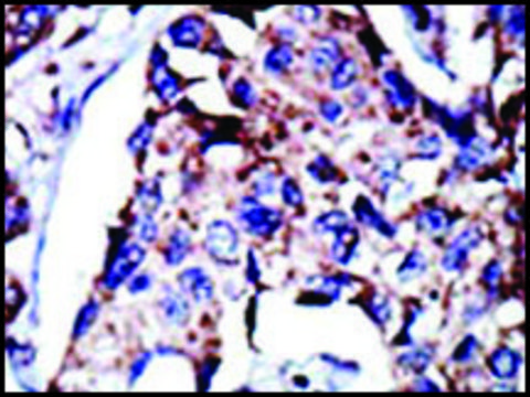 Anti-DGKD (C-term) antibody produced in