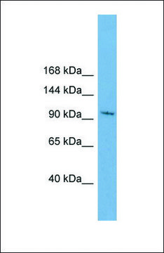 Anti-STK31, (N-terminal) antibody produced in