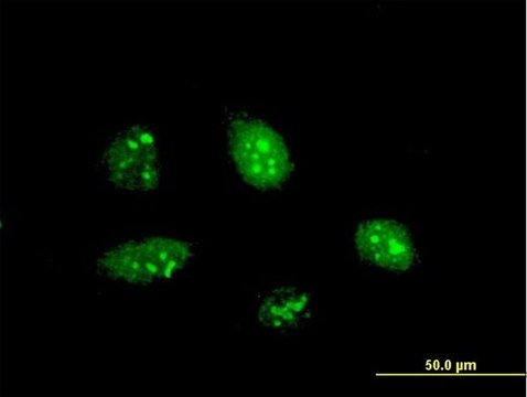 ANTI-PPARGC1A antibody produced in mouse