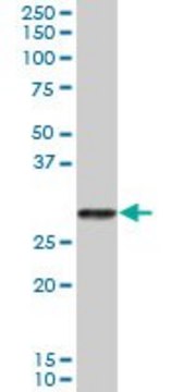 Anti-PRSS2 antibody produced in mouse