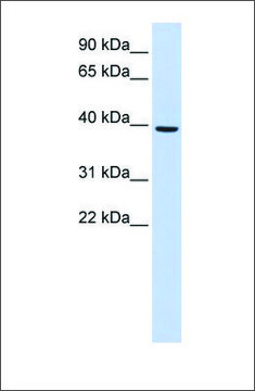 Anti-MOGAT2 antibody produced in rabbit