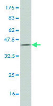 Monoclonal Anti-PFKL antibody produced in