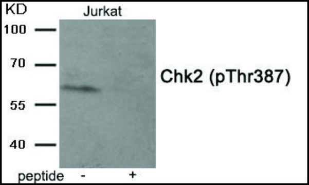 Anti-phospho-Chk2 (pThr³??) antibody produced in