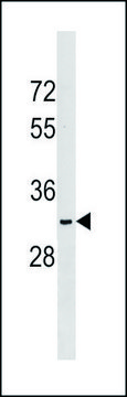 ANTI-NKX6-2 (N-TERM) antibody produced in