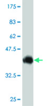 Monoclonal Anti-ABCC6 antibody produced in