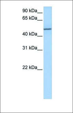 Anti-COL25A1 antibody produced in rabbit