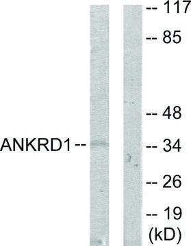 Anti-ANKRD1 antibody produced in rabbit