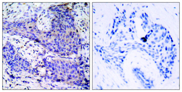 Anti-BAD antibody produced in rabbit