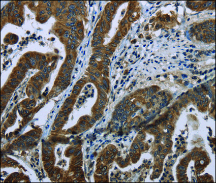 Anti-BRINP1 antibody produced in rabbit
