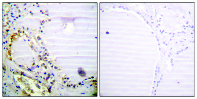 Anti-RBBP8 antibody produced in rabbit