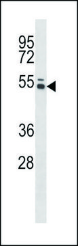 ANTI-MOUSE PTK6 (N-TERM) antibody produced