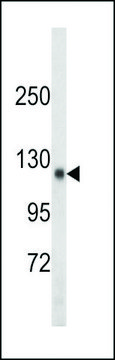ANTI-SDCCAG33 (CENTER) antibody produced in