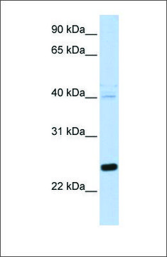 Anti-HSPB8 antibody produced in rabbit