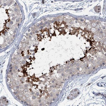 Anti-BIVM antibody produced in rabbit