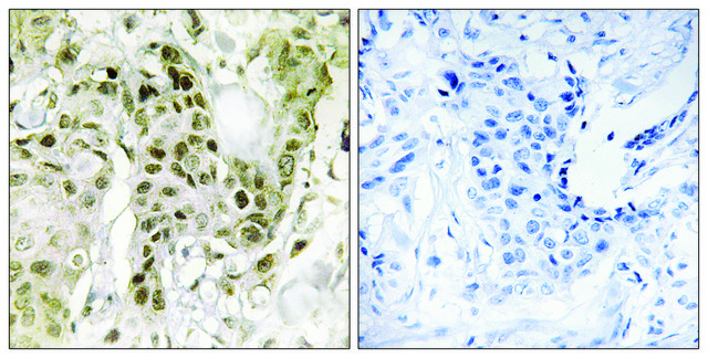 Anti-BCOR antibody produced in rabbit