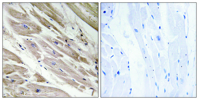 Anti-MYBPC3 antibody produced in rabbit