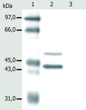 Monoclonal Anti-Cytokeratin 5/18 antibody produced