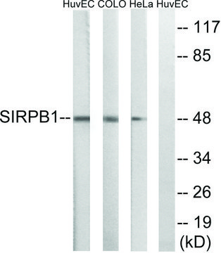 Anti-SIRPB1 antibody produced in rabbit