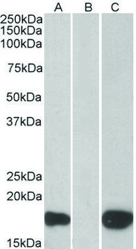 Anti-PHLDA3 (C-terminal) antibody produced in