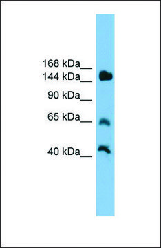 Anti-JARID2 antibody produced in rabbit