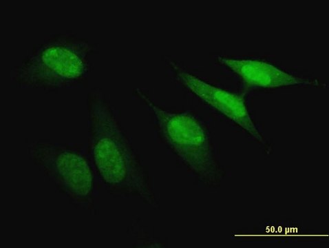 ANTI-PBK antibody produced in mouse