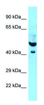 Anti-PLAUR (N-terminal) antibody produced in