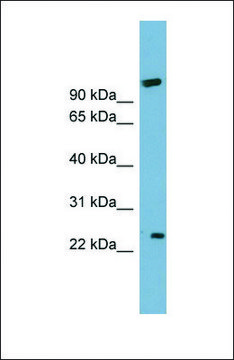 Anti-ARL8B antibody produced in rabbit