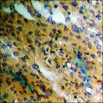 Anti-phospho-Estrogen Receptor-? (pSer??) antibody produced