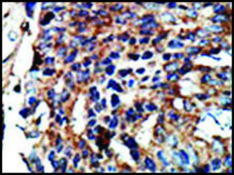 Anti-OPHN1L (C-term) antibody produced in