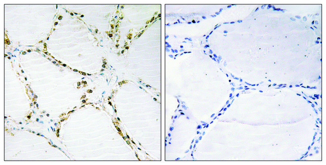 Anti-FOXO1A antibody produced in rabbit