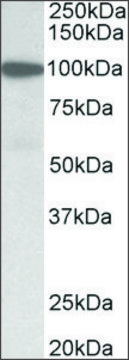 Anti-GSN (N-terminal) antibody produced in