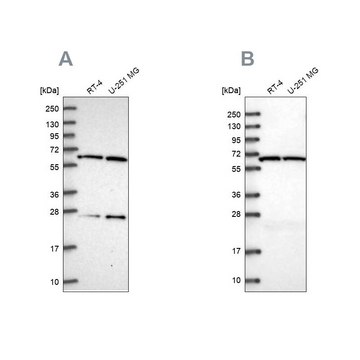 Anti-ACAD9 antibody produced in rabbit