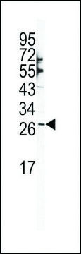 ANTI-SNAIL (N-TERM R8) antibody produced
