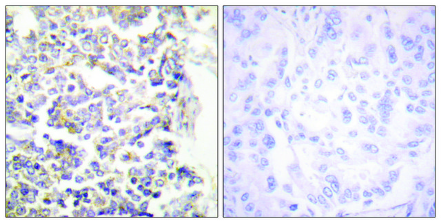 Anti-MARK3 antibody produced in rabbit