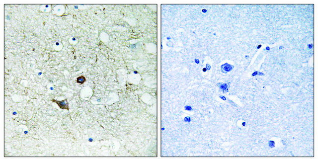 Anti-CASP2 antibody produced in rabbit