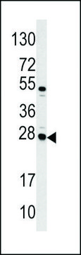 ANTI-CASA (CENTER) antibody produced in