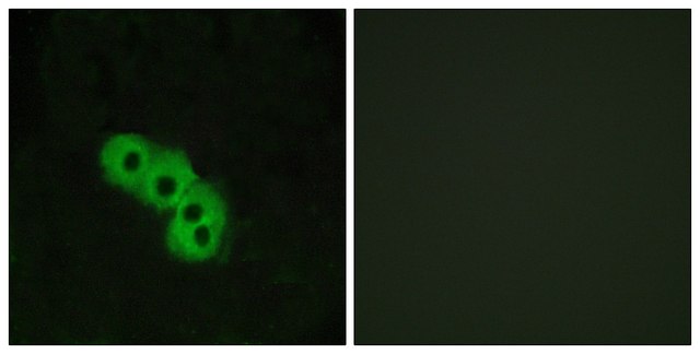 Anti-GPR109 antibody produced in rabbit