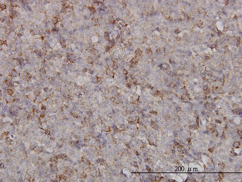 Monoclonal Anti-KIF2C antibody produced in